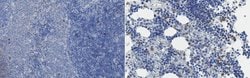 MMP-9, Rabbit anti-Rat, Human, Polyclonal, Millipore Sigma 25&mu;L; Unconjugated:Antibodies,